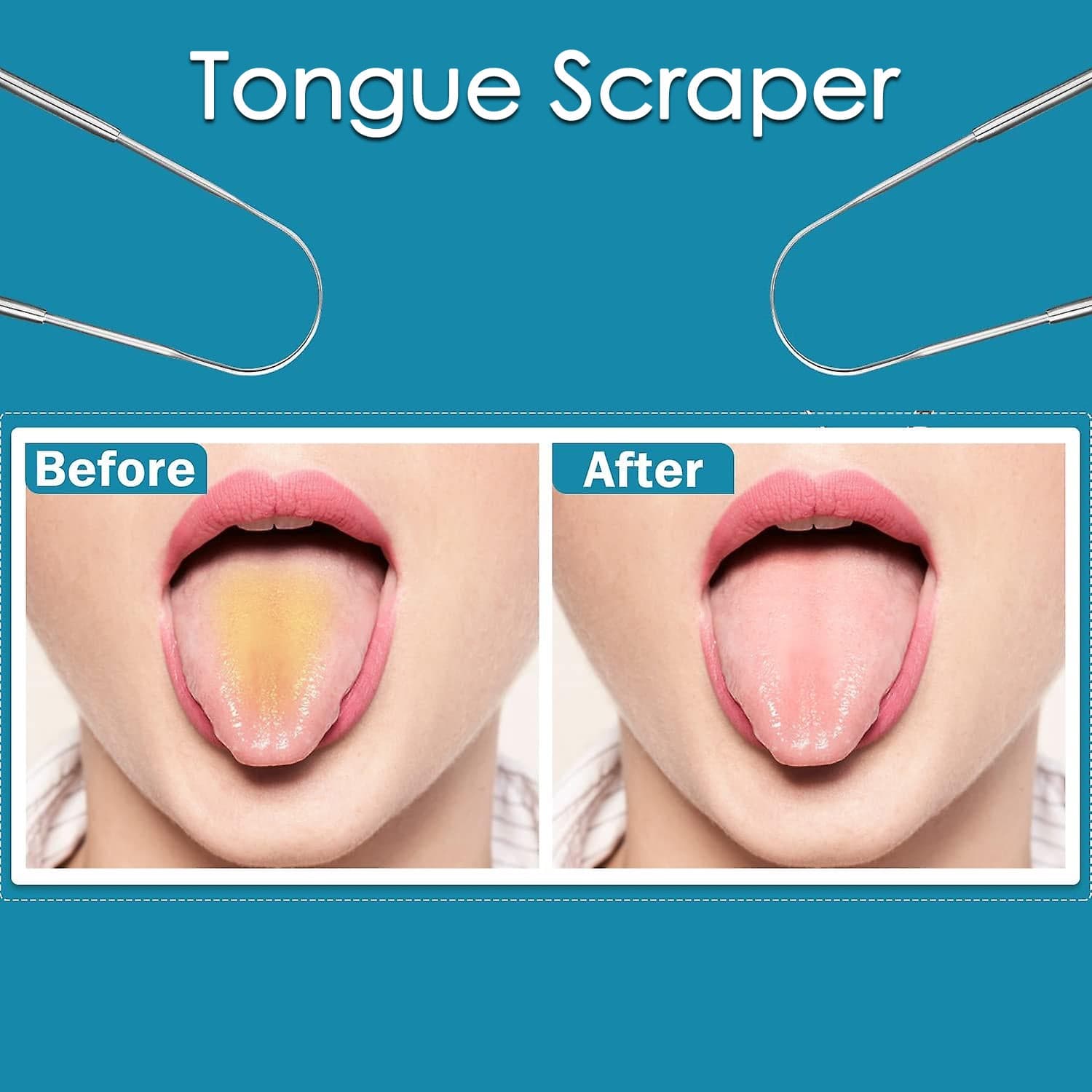 Tongue Cleaner For Kids & Adults | Tongue Scraper For Bad Breath ID-12593 thumbnail 4