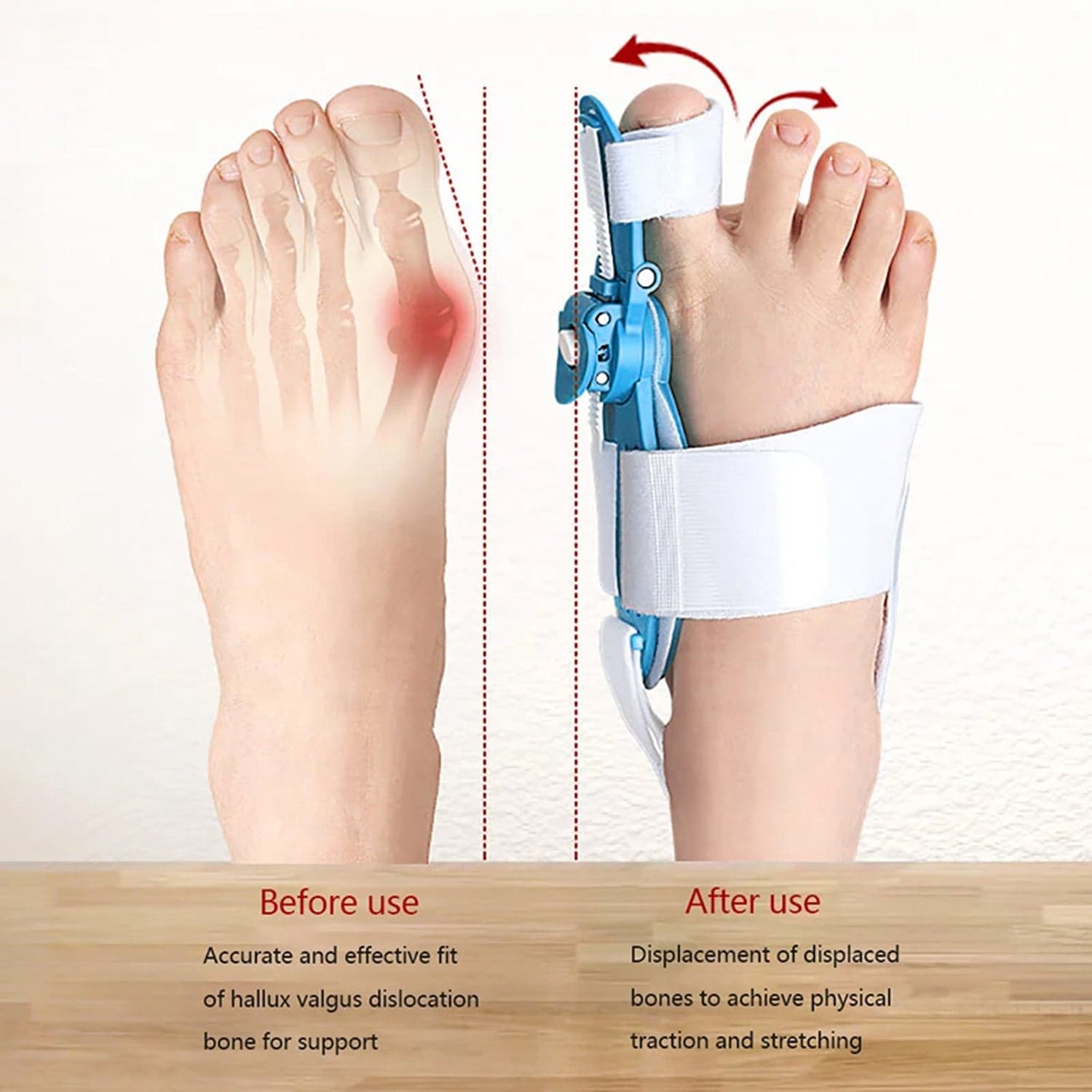 Adjustable Bunion Support Splint of Hallux Valgus Corrector for Men & Women thumbnail 5