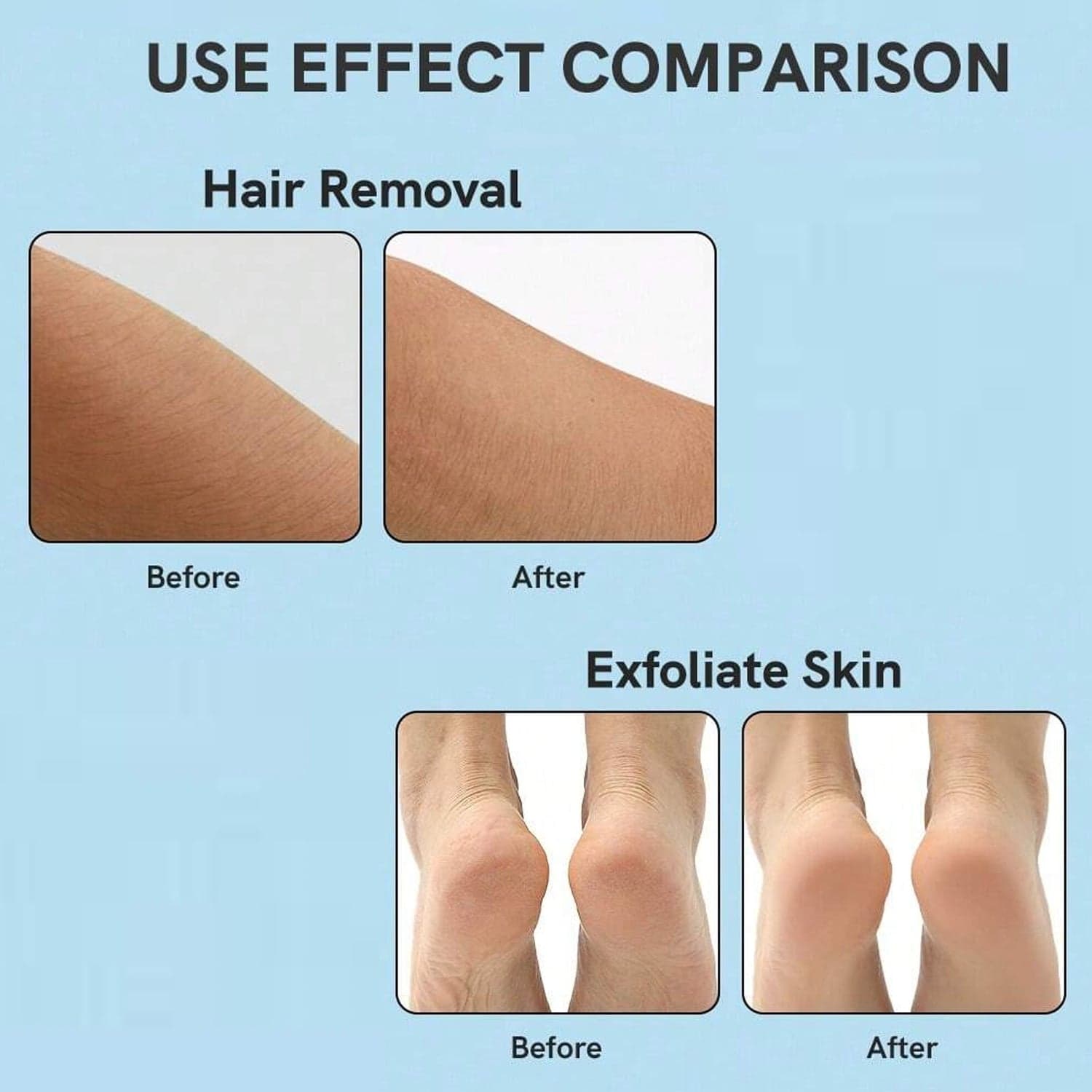 Nano Hair Remover for Arms, Legs, Back One Sided Skin Hair Remover (1 Pc) thumbnail 6