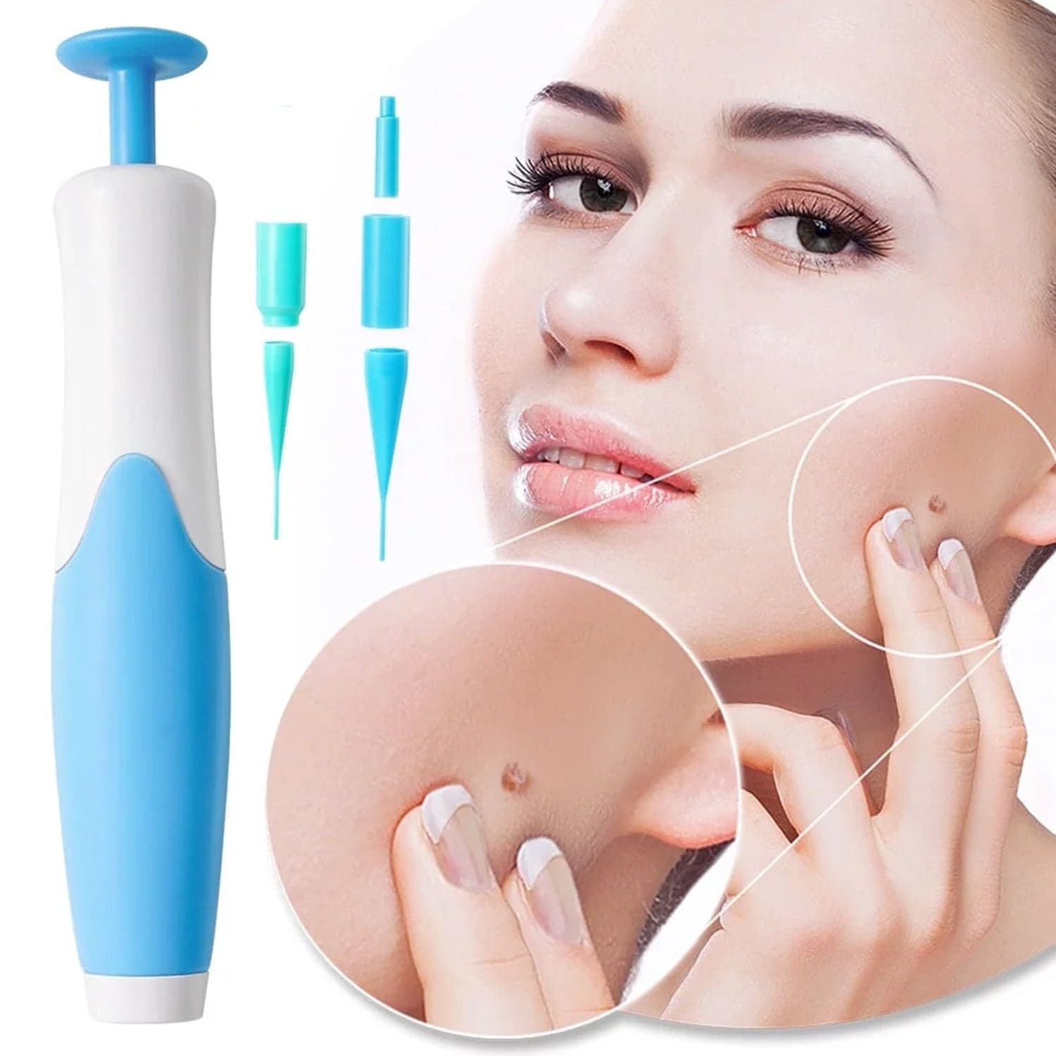 Skin Tag Remover Kit 2 in 1 for Micro to Large (2 mm - 8 mm / 1 Set) thumbnail 3