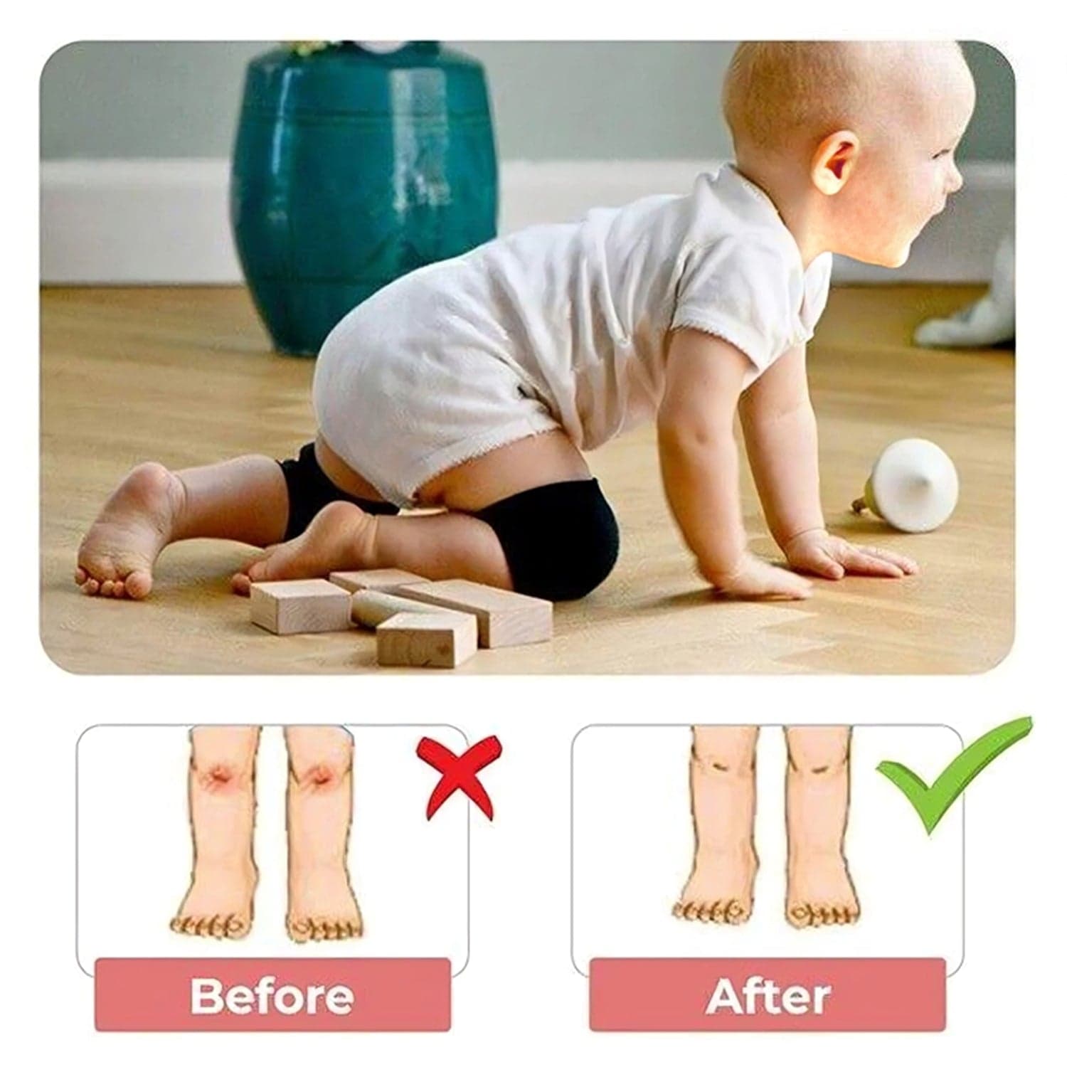 1 Pairs Baby Knee Pads for Crawling (1 Pair / 6 Cm) thumbnail 4