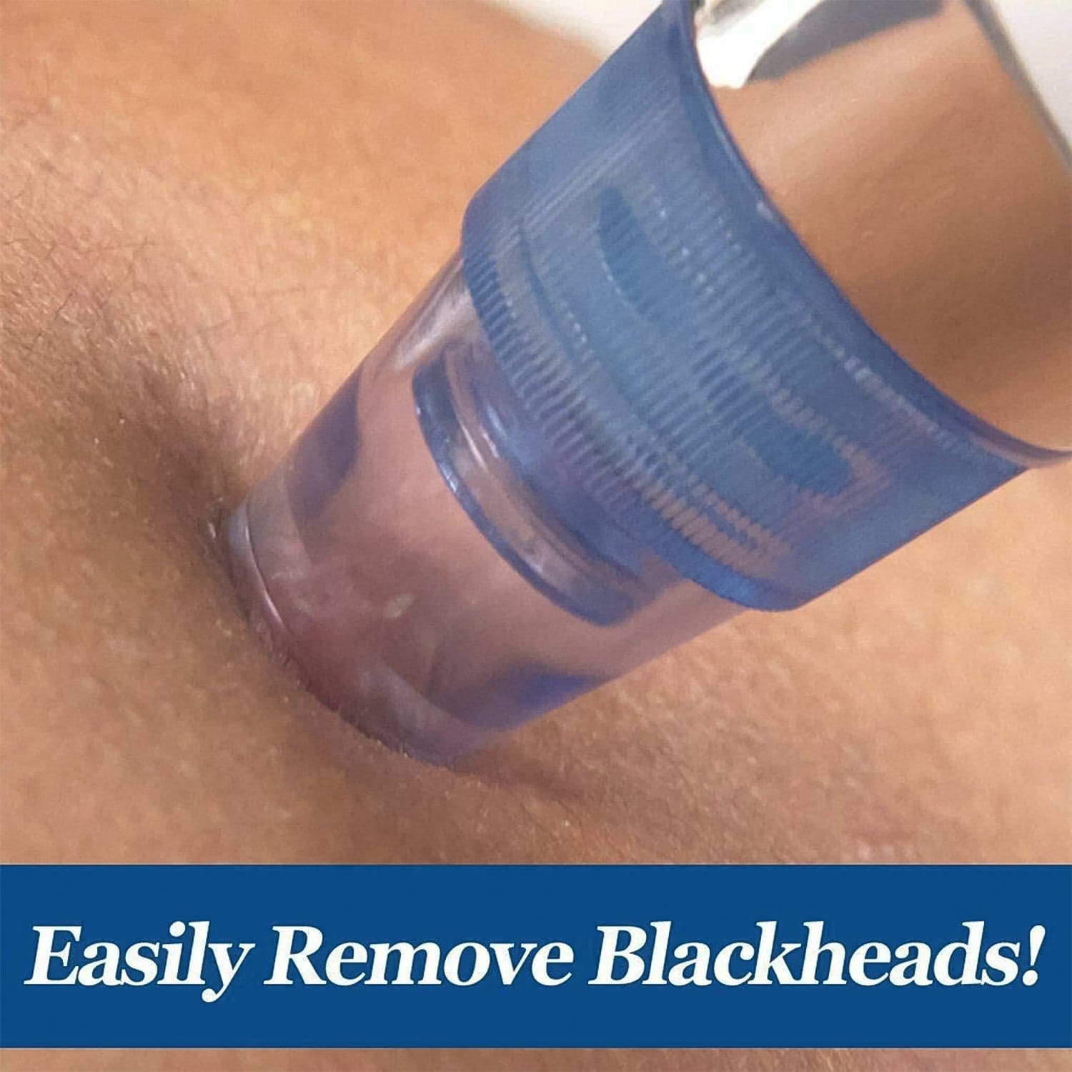 2 in 1 Blackhead Whitehead Extractor Remover Device (Multi-Color / 1 Set / batteries not included) thumbnail 4