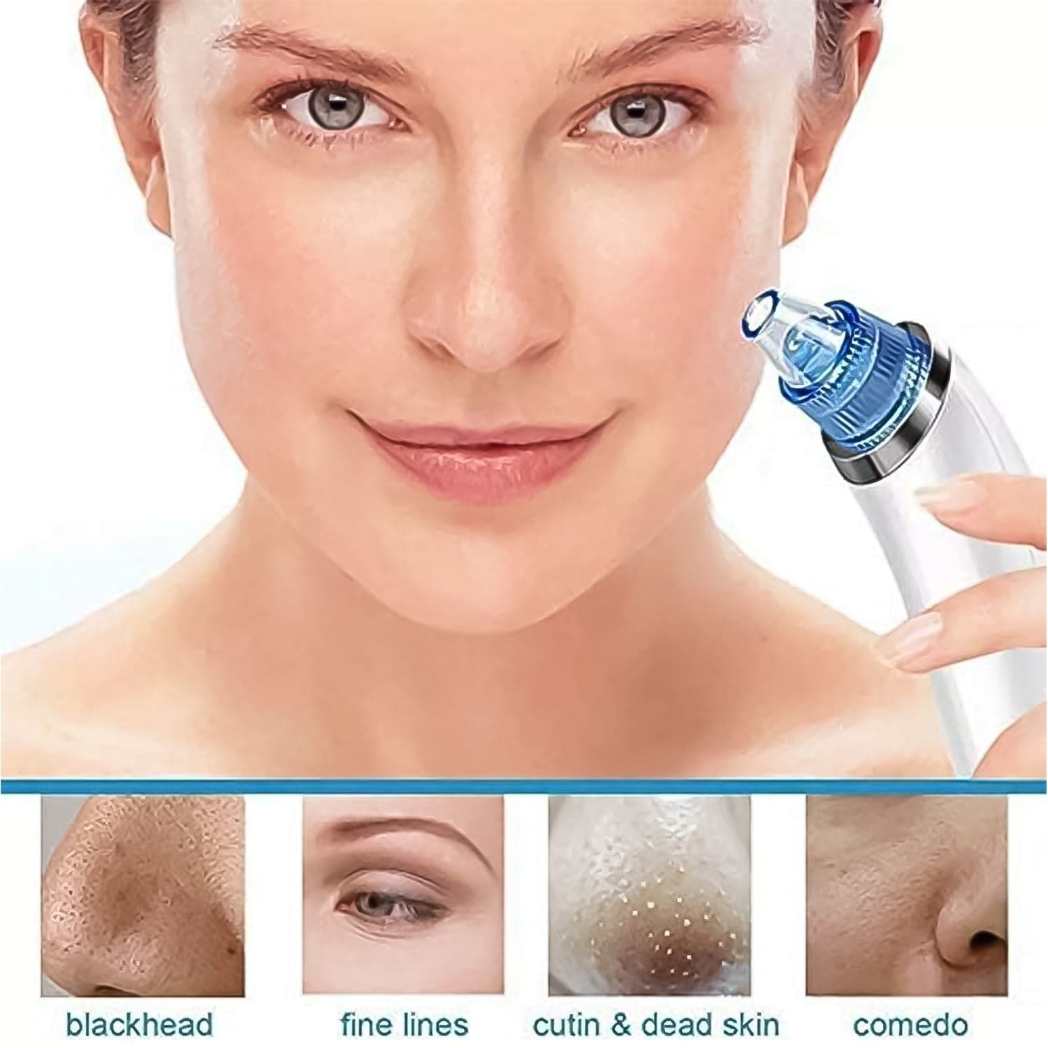 2 in 1 Blackhead Whitehead Extractor Remover Device (Multi-Color / 1 Set / batteries not included) thumbnail 7