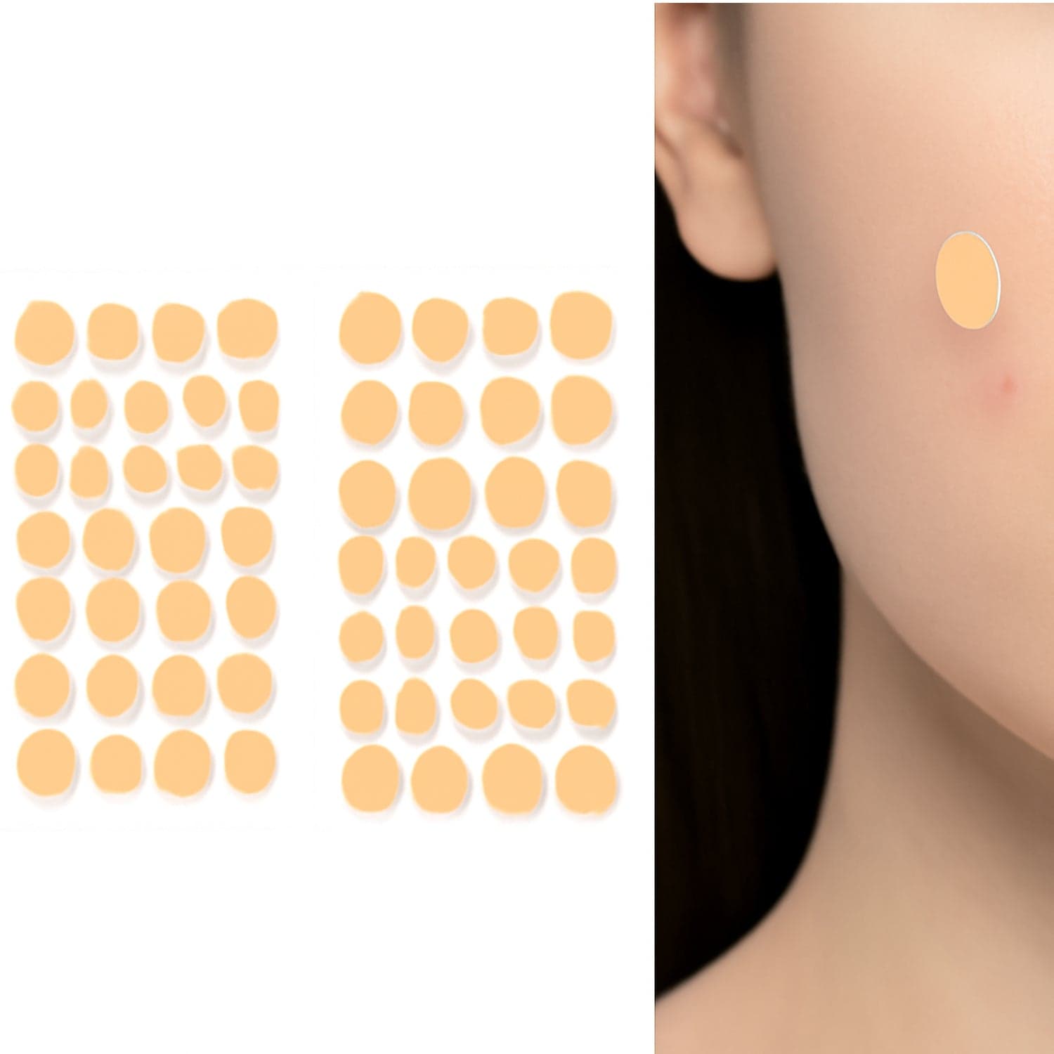 Pimple Patches for Face (1 Sheet Set) thumbnail 1