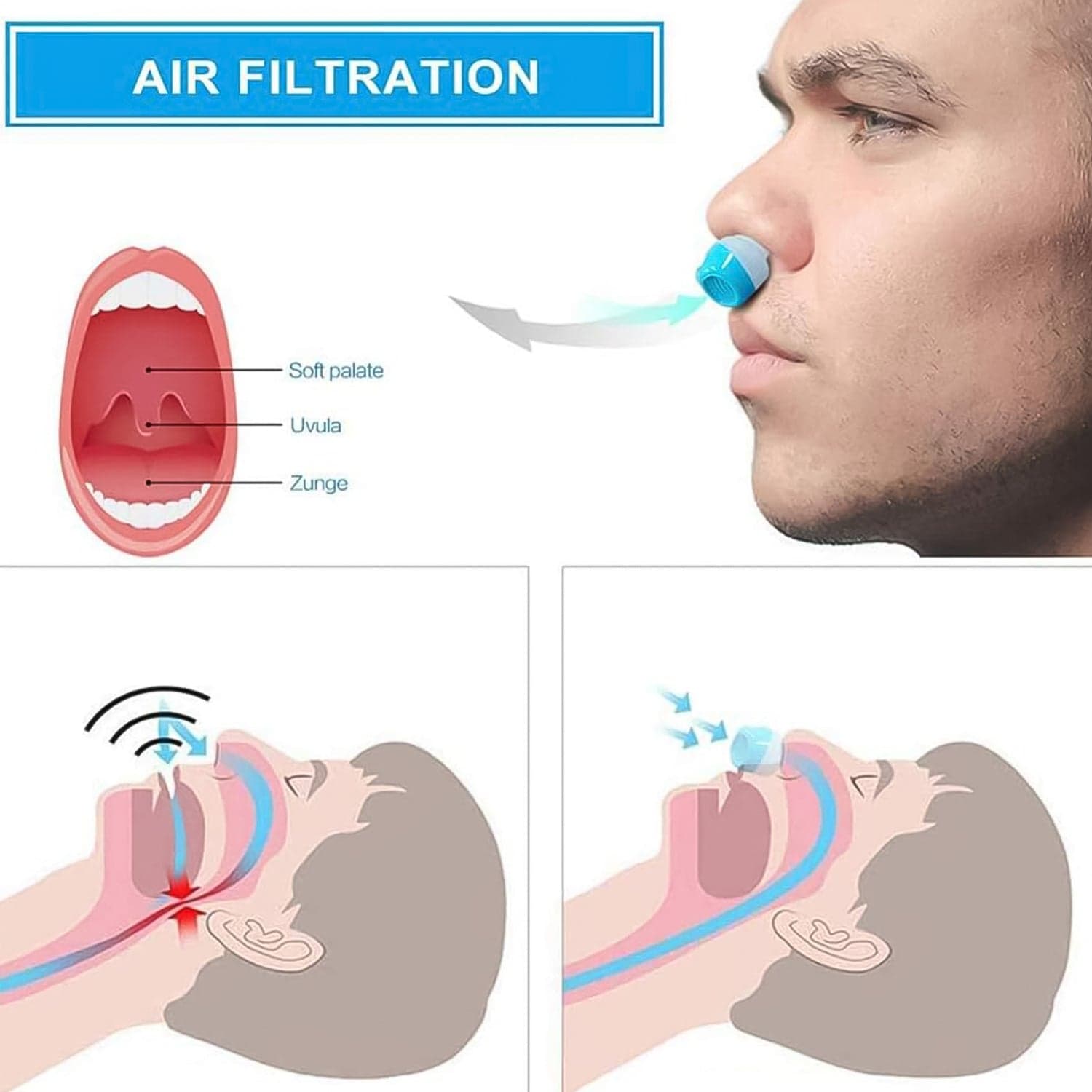 2 in 1 Anti Snoring and Air Purifier Nose Clip Anti Snoring Device (1 Pc / With Plastic Case) thumbnail 3