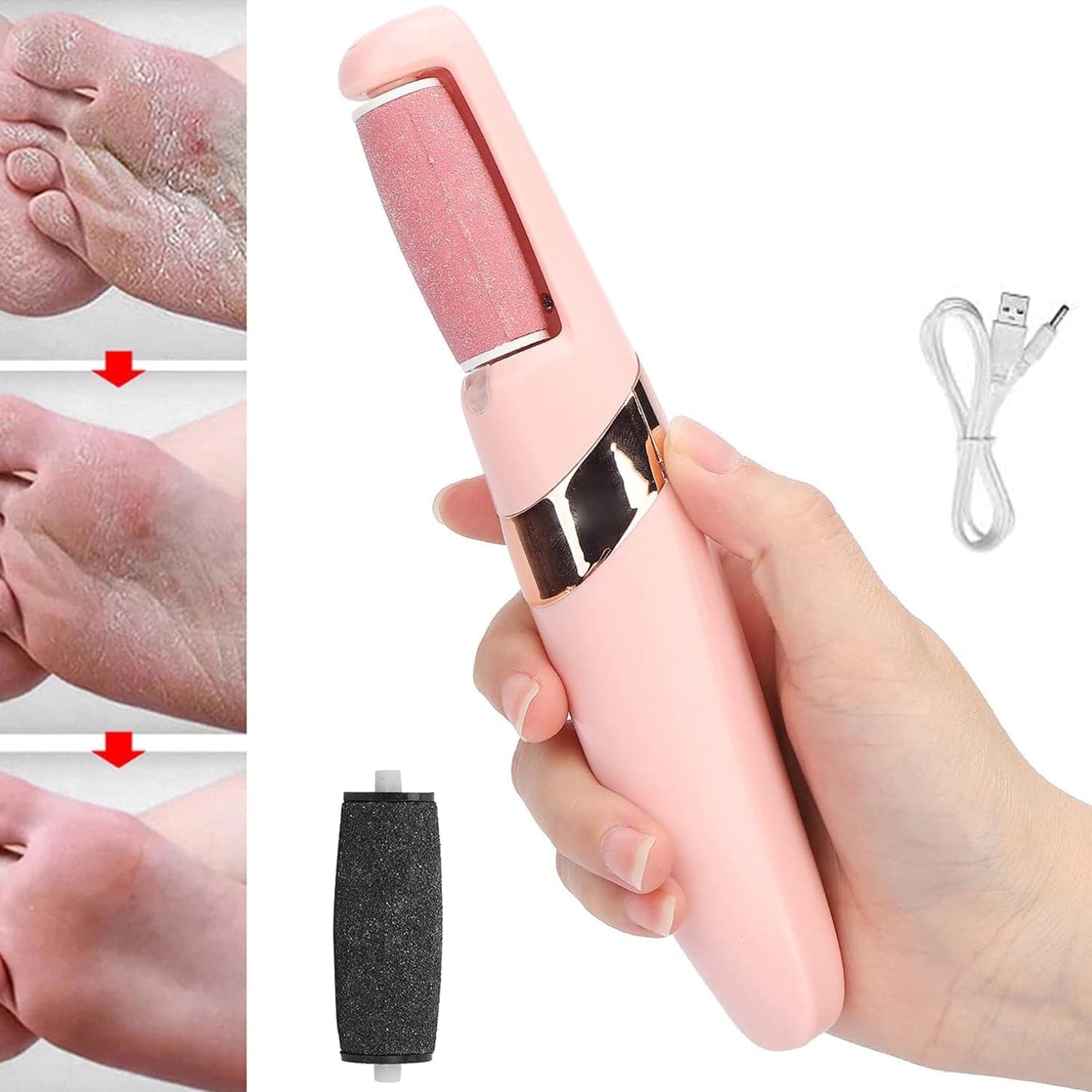 Flewless Pedi Electronic Pedicure Tool (1 Set) thumbnail 1