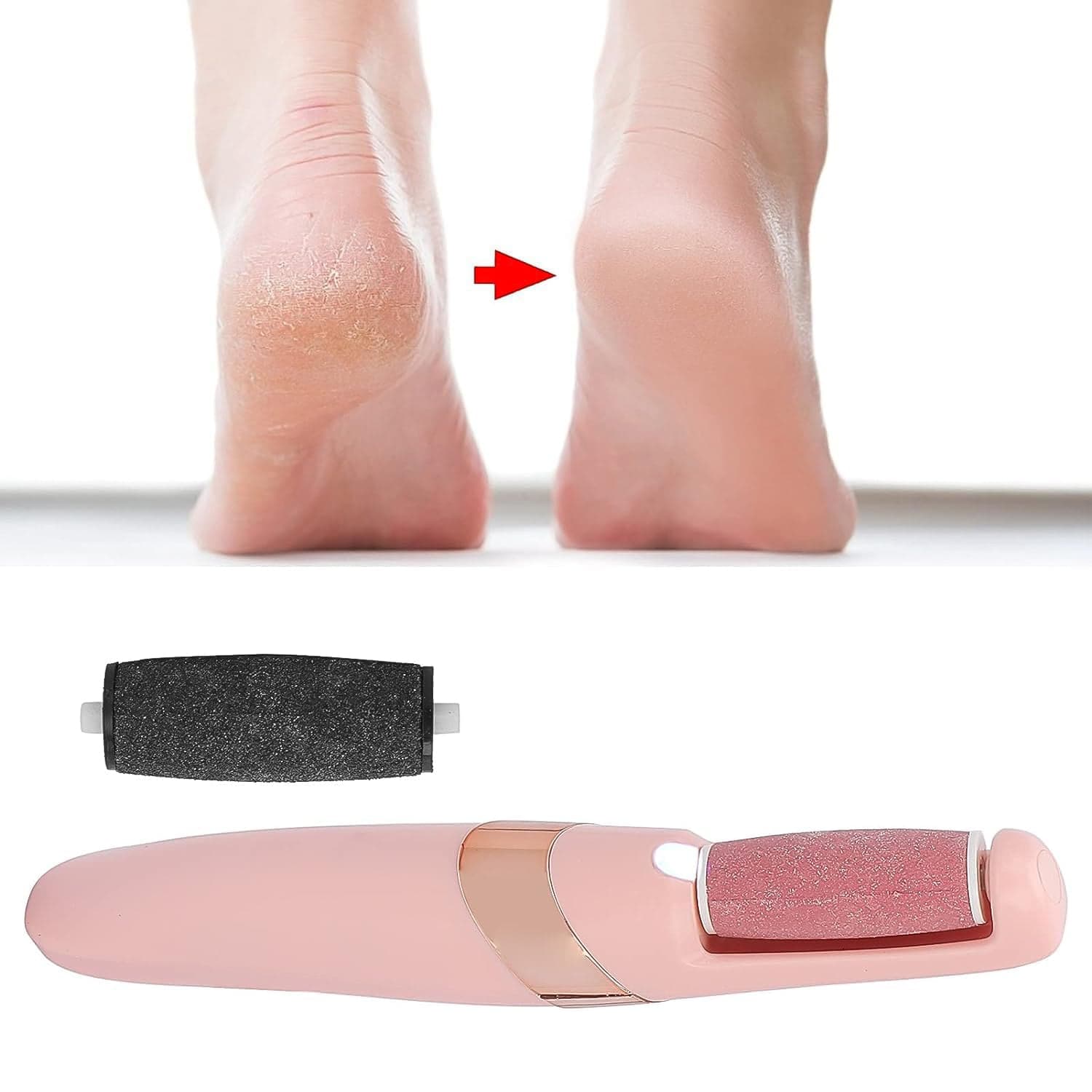 Flewless Pedi Electronic Pedicure Tool (1 Set) thumbnail 6