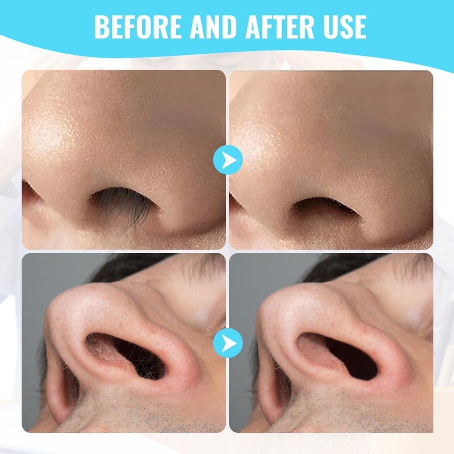 Nose Hair Removal Trimmer Nose Hair Remover Razor Kit Blade (3 Pcs Set) thumbnail 7