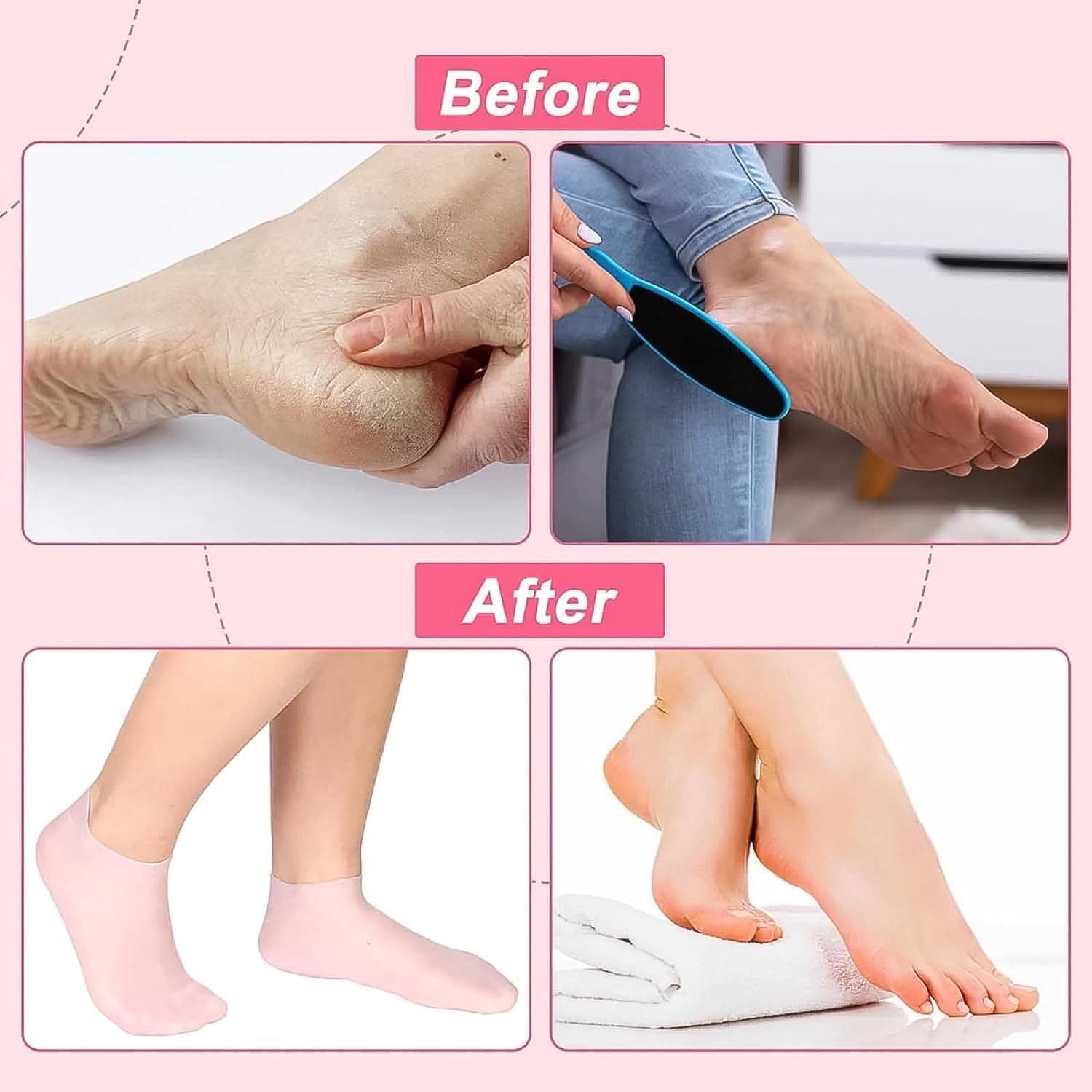 Silicone Moisturizing Socks (1 Pair) thumbnail 5
