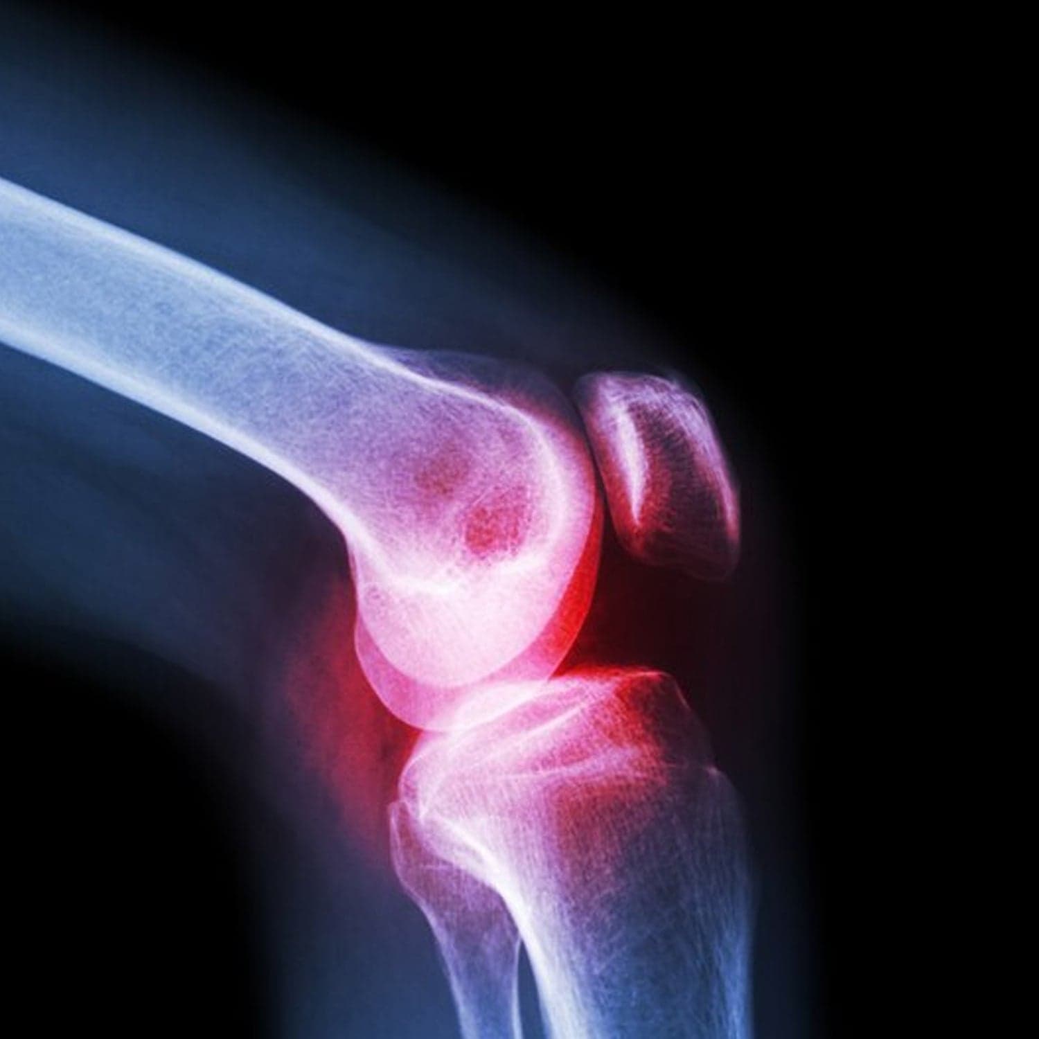 Knee Cap for Knee Support (Large) thumbnail 6